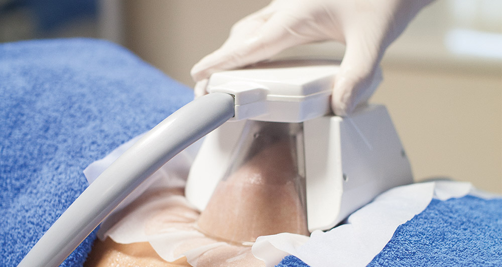 How Fat Freezing and HIFU Work Together? 2 Multiple Areas in One Session HIFU and Fat Freezing Bognor Regis