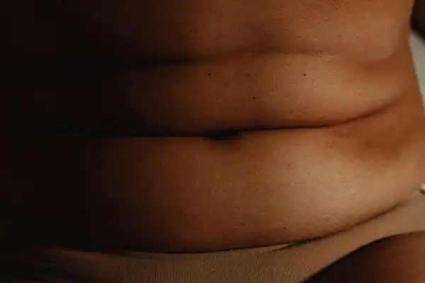 The Hidden Connection: How Stress Shapes Your Fitness and Body Composition 3 image of what stress can do on the stomach area and how Lipo 360 Bognor Regis can help to change your body shape.
