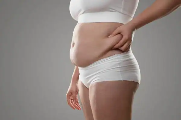 Image of stress belly Bognor Regis How Lipo 360 can help manage your symptoms